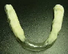 Bissorthese Bissorthese