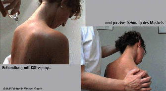Spraybehandlung Spraybehandlung
