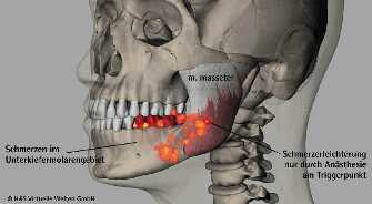 trigger_mass3 trigger_mass3