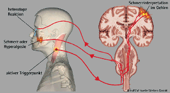 trigger_neuron__bertr1 trigger_neuron__bertr1